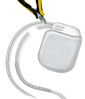 Knippen elektroden ICD pacemaker