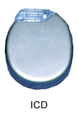 ICD pacemaker